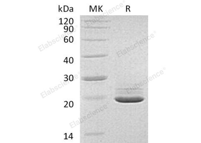 Recombinant Human PRAP1 Protein (His Tag) - ABMIUM