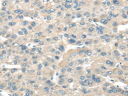 Anti-Human/Mouse TNFAIP8 Antibody
