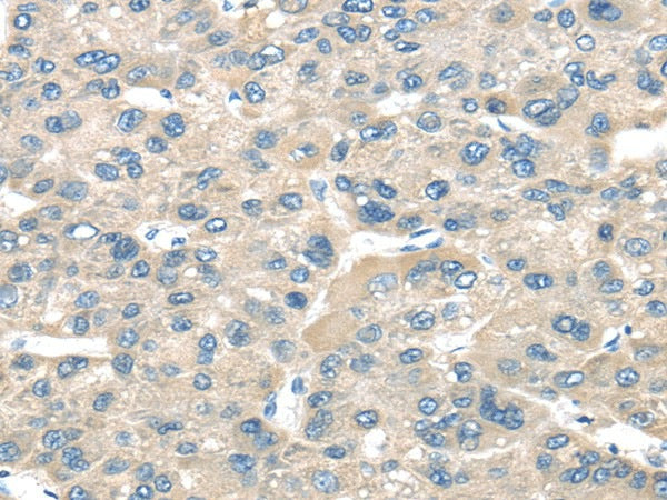 Anti-Human/Mouse TNFAIP8 Antibody - ABMIUM