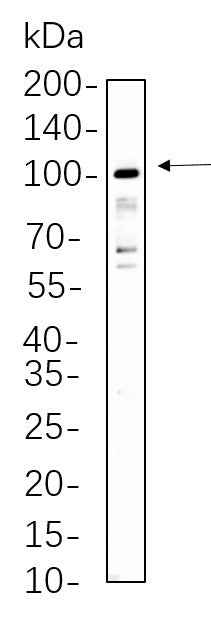 Anti-Human/Mouse/Rat STAT5A/B Antibody [B759] - ABMIUM