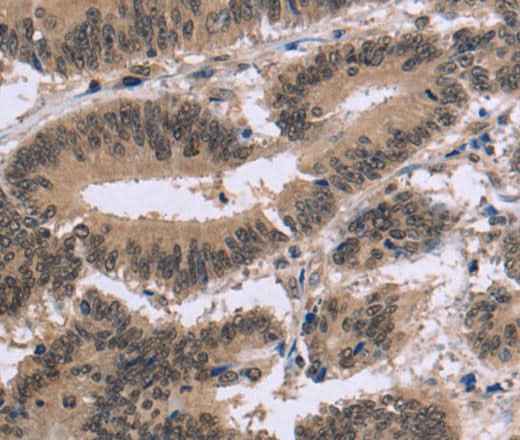 Anti-Human FAM107A Antibody
