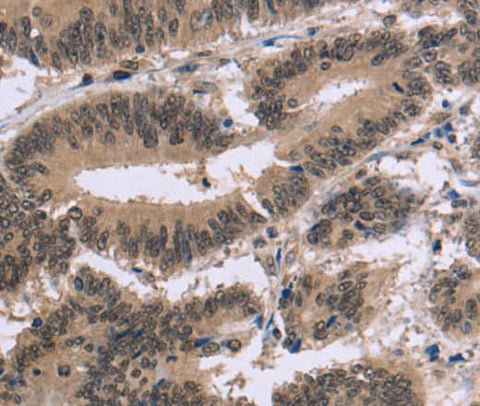 Anti-Human FAM107A Antibody - ABMIUM