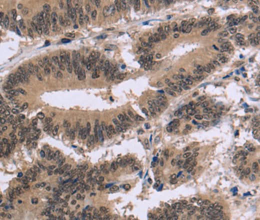 Anti-Human FAM107A Antibody - ABMIUM