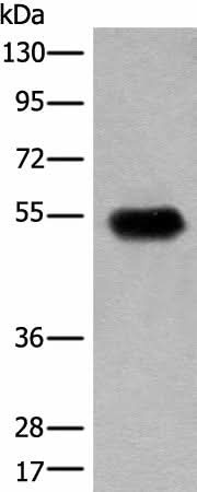 Anti-Human CDT1 Antibody - ABMIUM