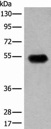 Anti-Human CDT1 Antibody - ABMIUM