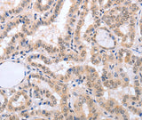 Anti-Human FADD Antibody - ABMIUM