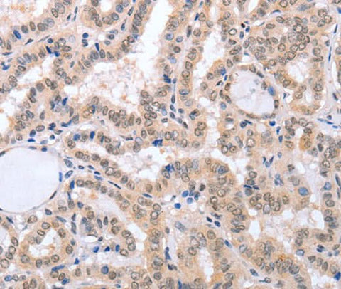 Anti-Human FADD Antibody - ABMIUM