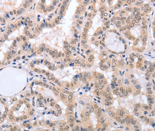 Anti-Human FADD Antibody - ABMIUM