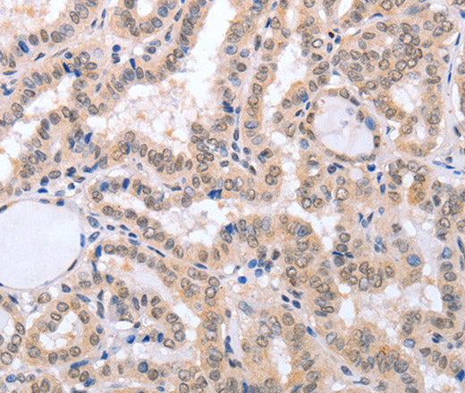 Anti-Human FADD Antibody - ABMIUM