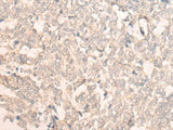 Anti-Human FAN1 Antibody - ABMIUM