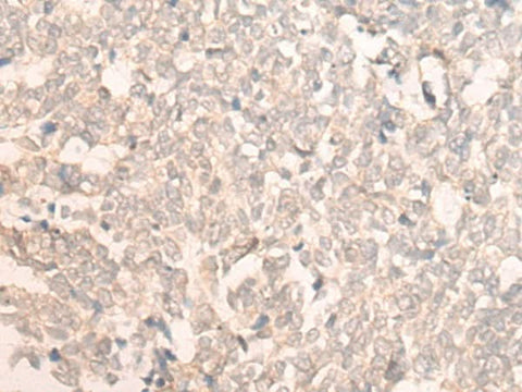 Anti-Human FAN1 Antibody - ABMIUM