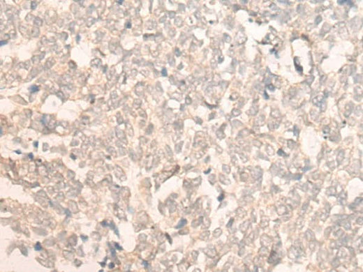 Anti-Human FAN1 Antibody - ABMIUM