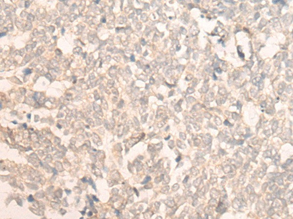 Anti-Human FAN1 Antibody - ABMIUM