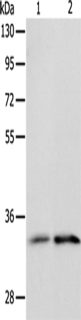 Anti-Human IL1RL1 Antibody - ABMIUM