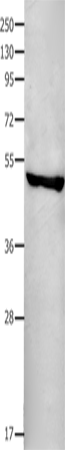 Anti-Human FAS Antibody - ABMIUM