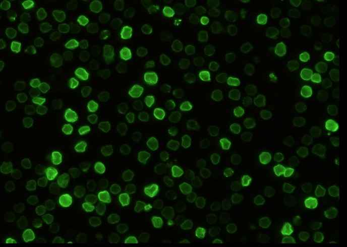 Anti-Mouse BSG Antibody [B440] - ABMIUM