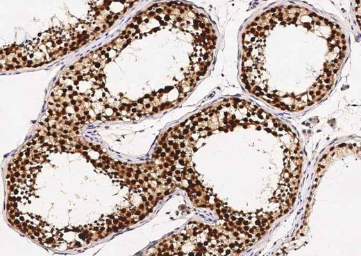 Anti-Human ASF1B Antibody [B377] - ABMIUM