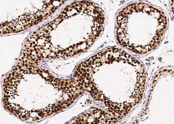 Anti-Human ASF1B Antibody [B377]