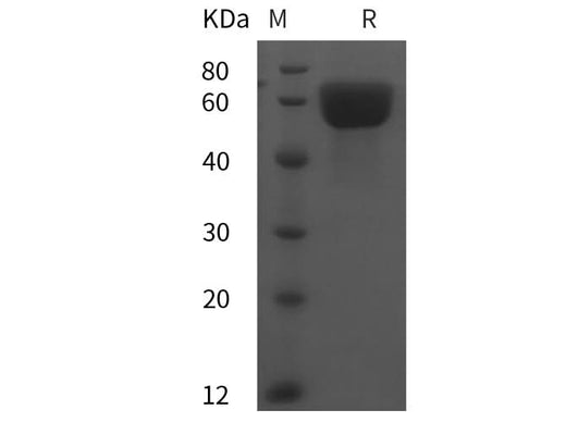 SDS-PAGE analysis of Rat Angiotensinogen/AGT proteins, 2 μg/lane of Recombinant Rat Angiotensinogen/AGT proteins was resolved with SDS-PAGE under reducing conditions, showing bands at 60 kDa.