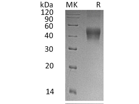 Recombinant Human IL-21R Protein (His Tag) - ABMIUM