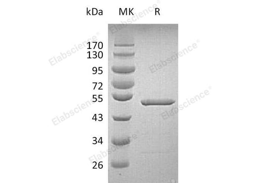 Recombinant Human Grancalcin/GCA Protein (GST Tag) - ABMIUM
