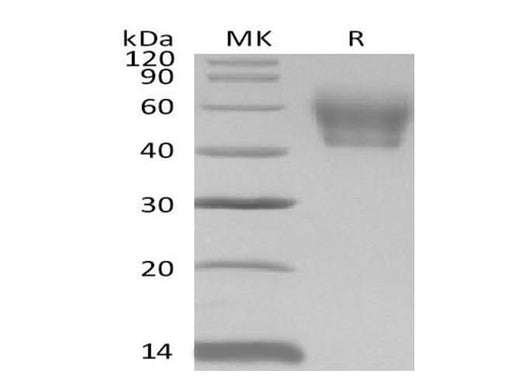 Recombinant Mouse IL1R2/CD121b Protein (His Tag) - ABMIUM