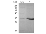 Recombinant Human DTD1 Protein (His Tag) - ABMIUM