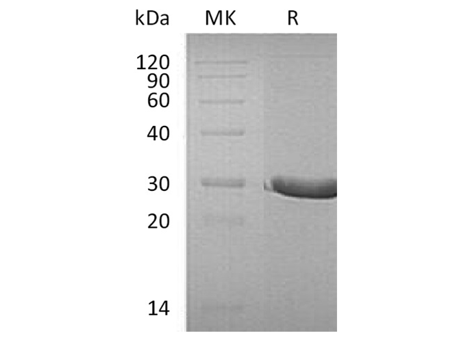 Recombinant Human DTD1 Protein (His Tag) - ABMIUM