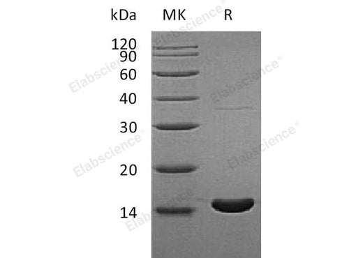 Recombinant Human RBP5 Protein - ABMIUM