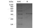 Recombinant Human Kallikrein 2/KLK2 Protein (His Tag) - ABMIUM