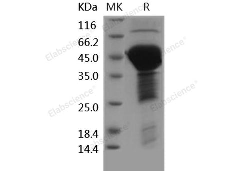Recombinant Human MAPT/Tau Protein (His Tag) - ABMIUM