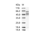 Recombinant RSV Fusion protein / RSV-F (Strain RSS-2) Protein (His Tag) - ABMIUM