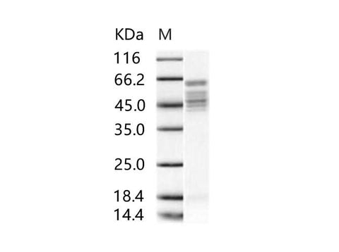 Recombinant RSV Fusion protein / RSV-F (Strain RSS-2) Protein (His Tag) - ABMIUM