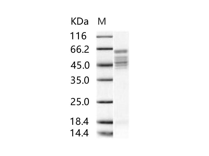Recombinant RSV Fusion protein / RSV-F (Strain RSS-2) Protein (His Tag) - ABMIUM