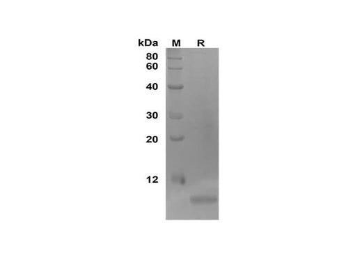 SDS-PAGE analysis of Human GRO proteins, 2 μg/lane of Recombinant Human GRO proteins was resolved with SDS-PAGE under reducing conditions, showing bands at 10 kDa.