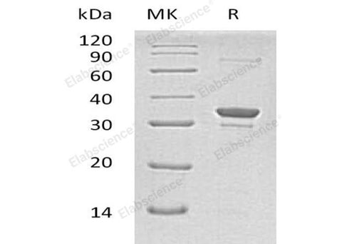 Recombinant Human SULT1A2 Protein (His Tag) - ABMIUM
