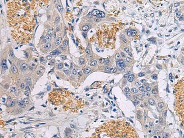 Anti-Human/Mouse/Rat CHST3 Antibody
