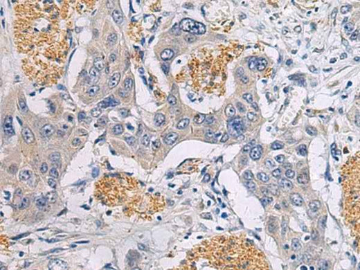 Anti-Human/Mouse/Rat CHST3 Antibody