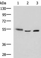 Western blot analysis of Human skin tissue A172 cell Human bladder transitional cell carcinoma grade 2-3 tissue lysates using IKZF2 Polyclonal Antibody at dilution of 1:950