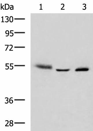 Western blot analysis of Human skin tissue A172 cell Human bladder transitional cell carcinoma grade 2-3 tissue lysates using IKZF2 Polyclonal Antibody at dilution of 1:950
