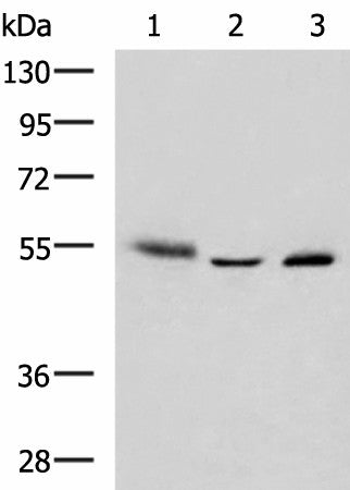 Western blot analysis of Human skin tissue A172 cell Human bladder transitional cell carcinoma grade 2-3 tissue lysates using IKZF2 Polyclonal Antibody at dilution of 1:950