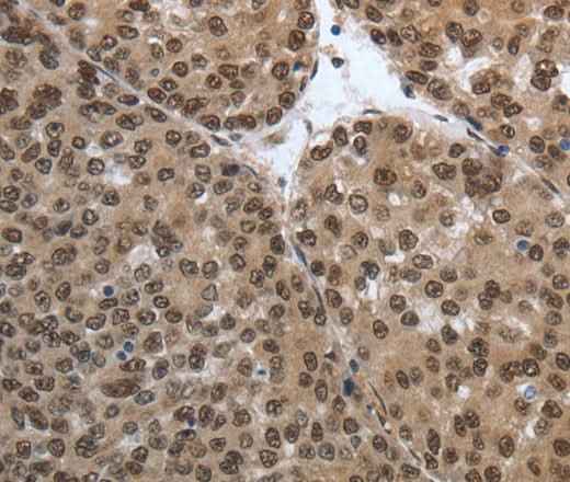 Anti-Human/Mouse/Rat SMAD7 Antibody