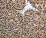 Anti-Human/Mouse/Rat SMAD7 Antibody - ABMIUM