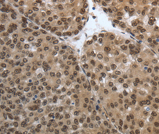 Anti-Human/Mouse/Rat SMAD7 Antibody - ABMIUM