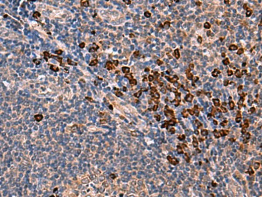 Immunohistochemistry of paraffin-embedded Human tonsil tissue using INSM2 Polyclonal Antibody at dilution of 1:35(×200)