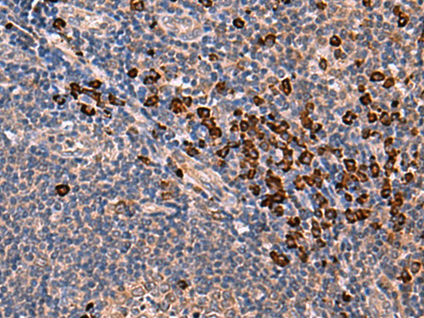 Immunohistochemistry of paraffin-embedded Human tonsil tissue using INSM2 Polyclonal Antibody at dilution of 1:35(×200)