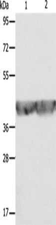 Anti-Human/Mouse/Rat ALDOA Antibody - ABMIUM
