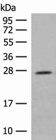 Anti-Human/Rat MDFI Antibody