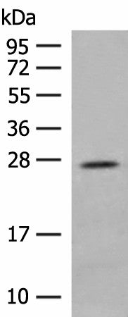 Western blot analysis of Human placenta tissue lysate using MDFI Polyclonal Antibody at dilution of 1:400