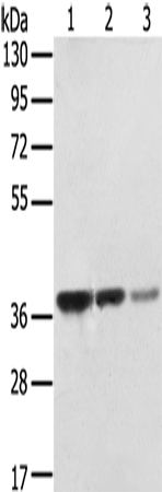 Anti-Human/Mouse STX16 Antibody - ABMIUM